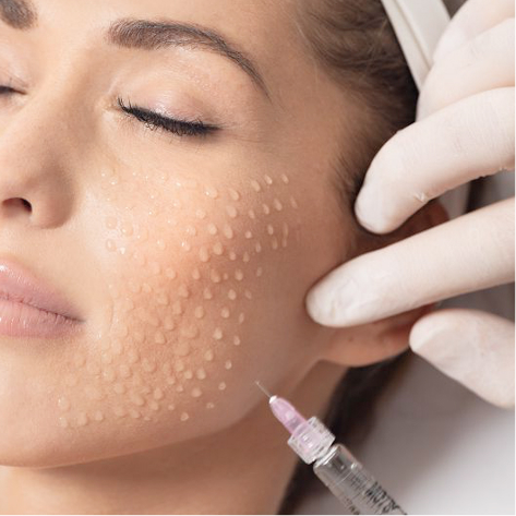 PRESENSA Fullnesse